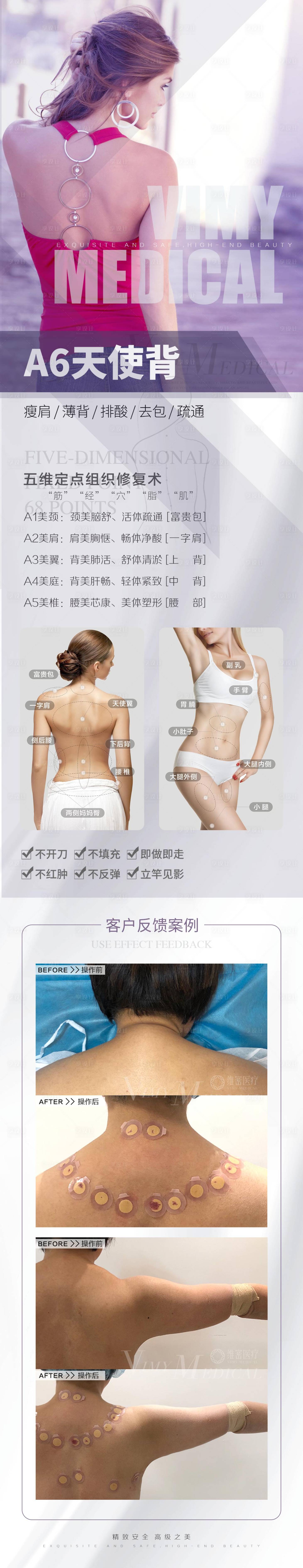 源文件下载【医美背部长图海报】编号：55100006316333263