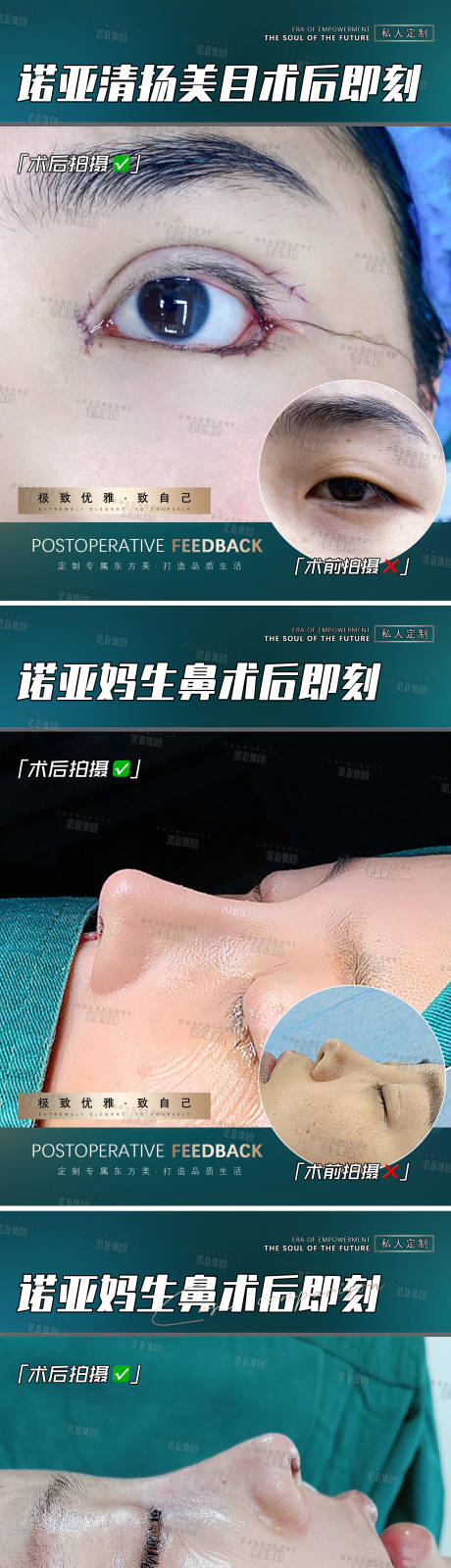 源文件下载【医美整形案例海报】编号：72120006549065002