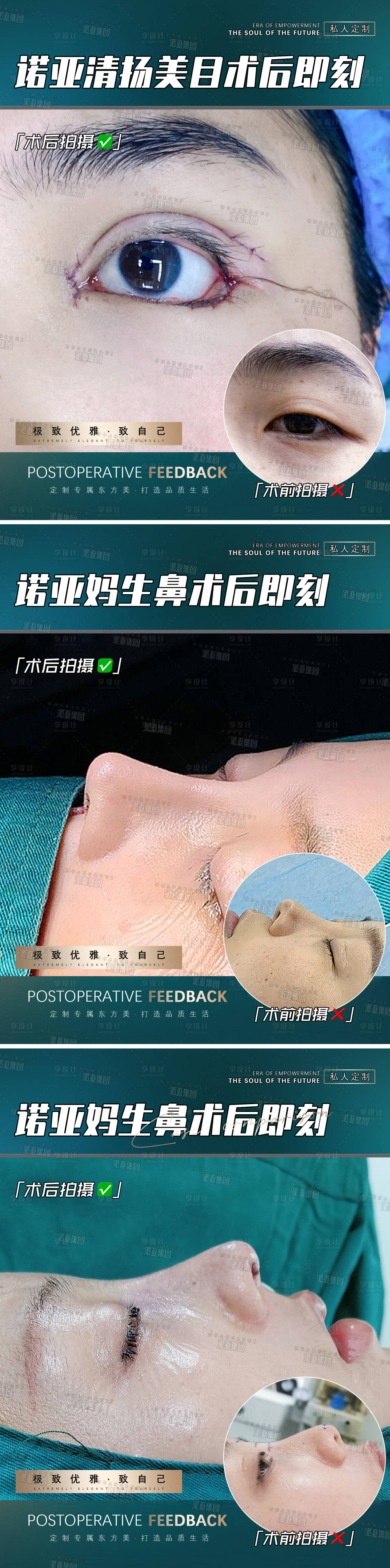 源文件下载【享设计】搜索编号：72120006549065002【医美整形案例海报】