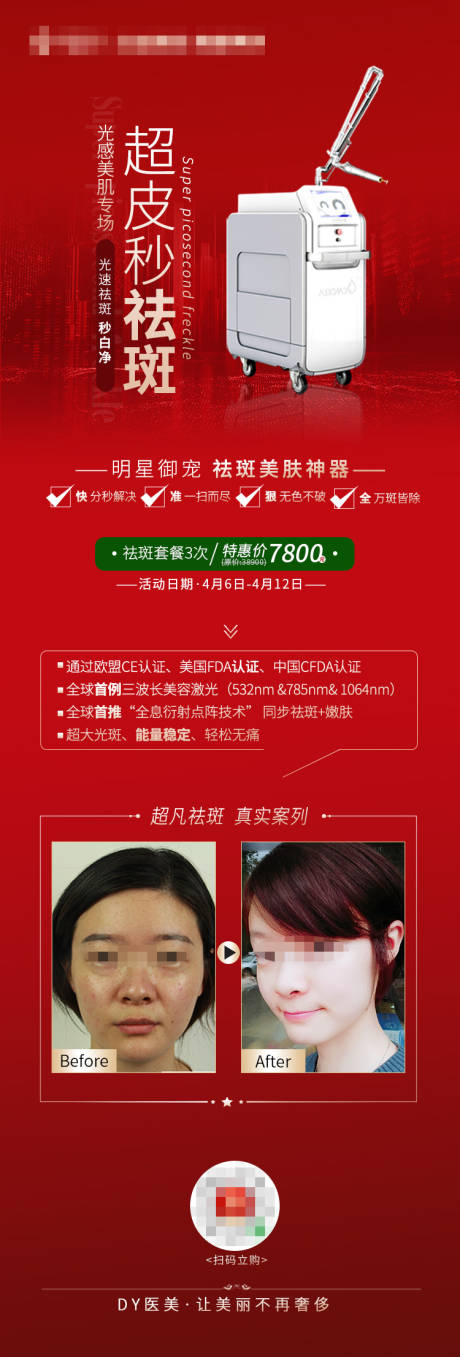 源文件下载【享设计】搜索编号：30120006406534491【医美超皮秒案例对比长图海报】