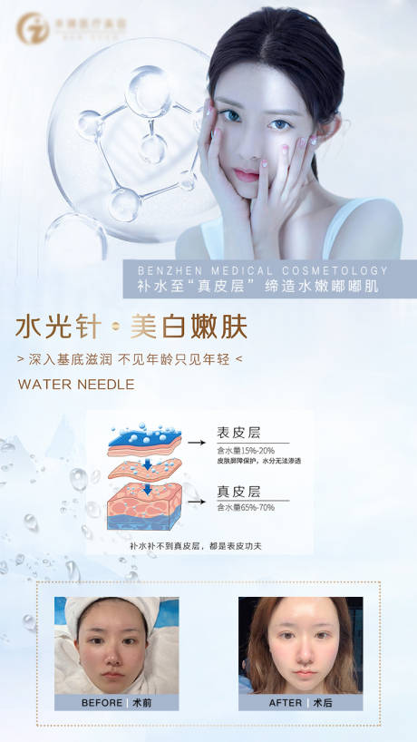 源文件下载【医美水光针人物海报】编号：19310006397822520