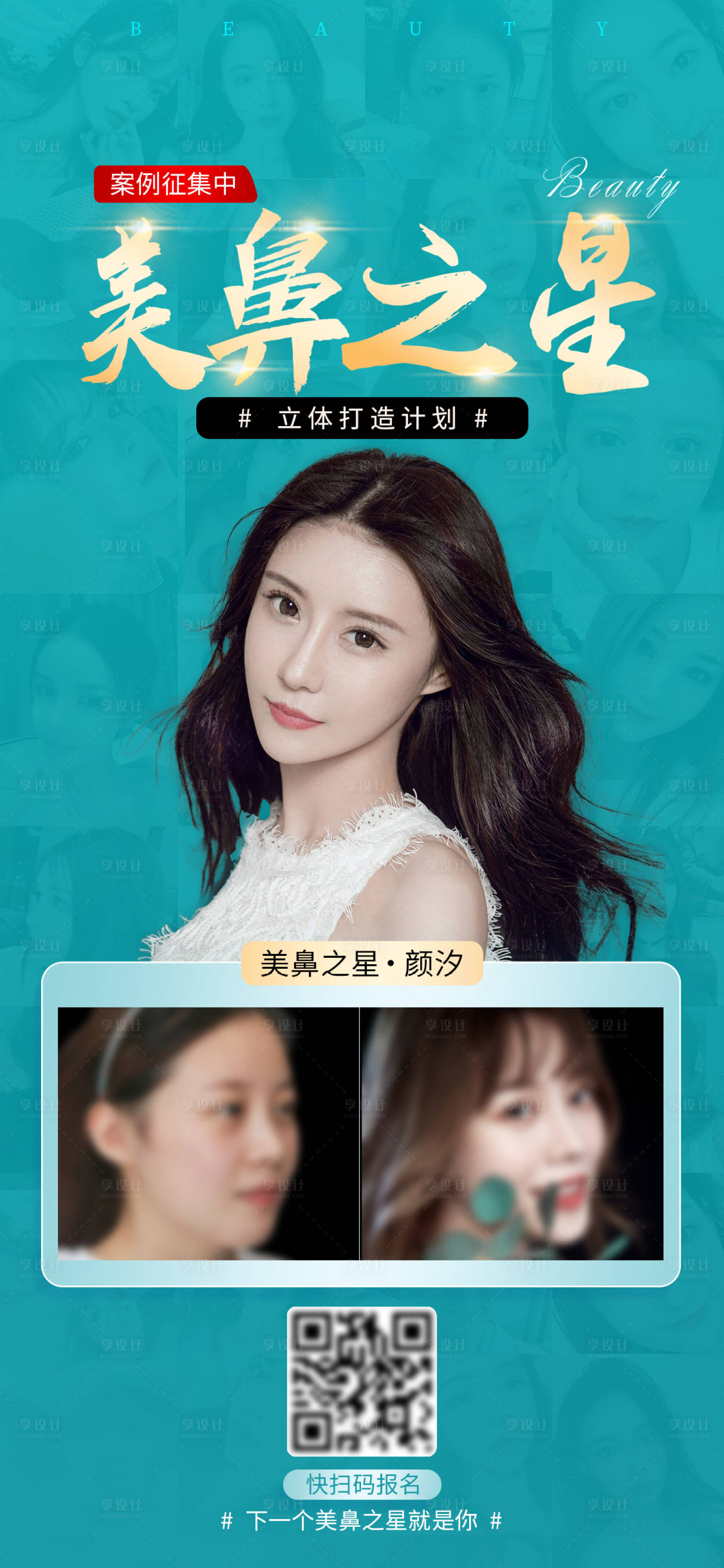 源文件下載【醫美整形 美鼻 案例招募海報】編號：12930006548158853