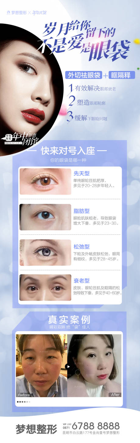 源文件下载【祛眼袋   】编号：89720006785872255