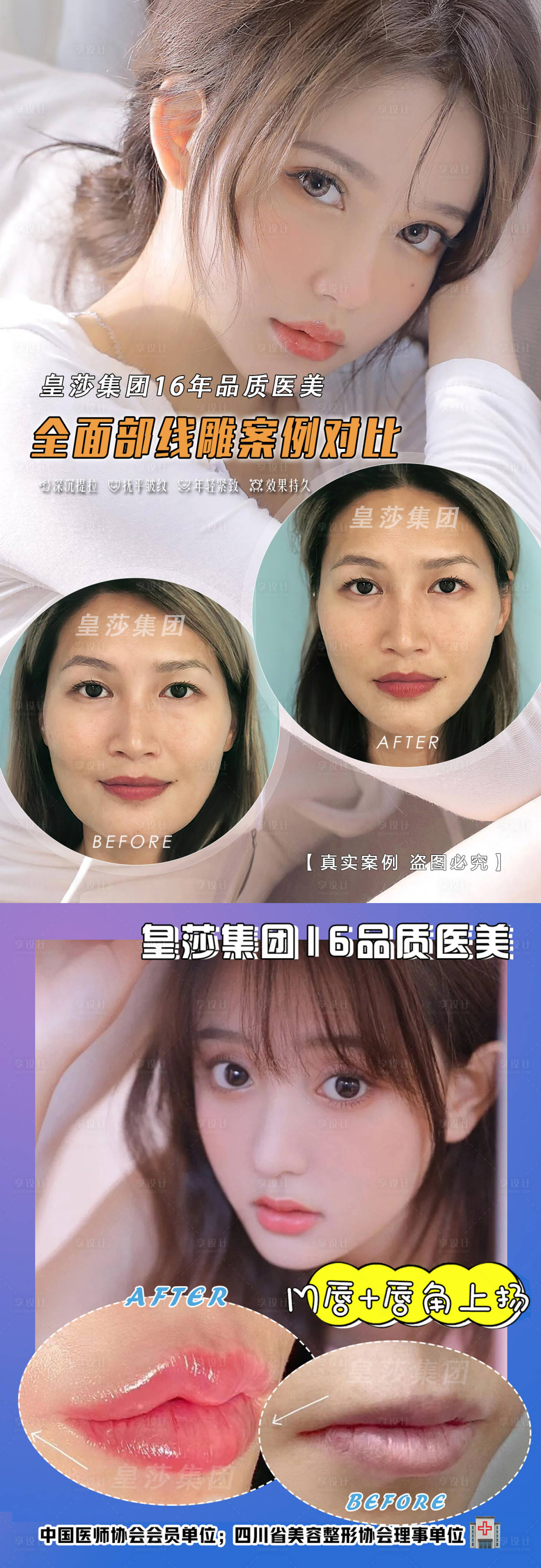 源文件下載【享設計】搜索編號：99120006944816656【醫(yī)美案例對比海報】