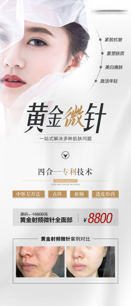 源文件下載【黃金微針海報】編號：35320006759329124