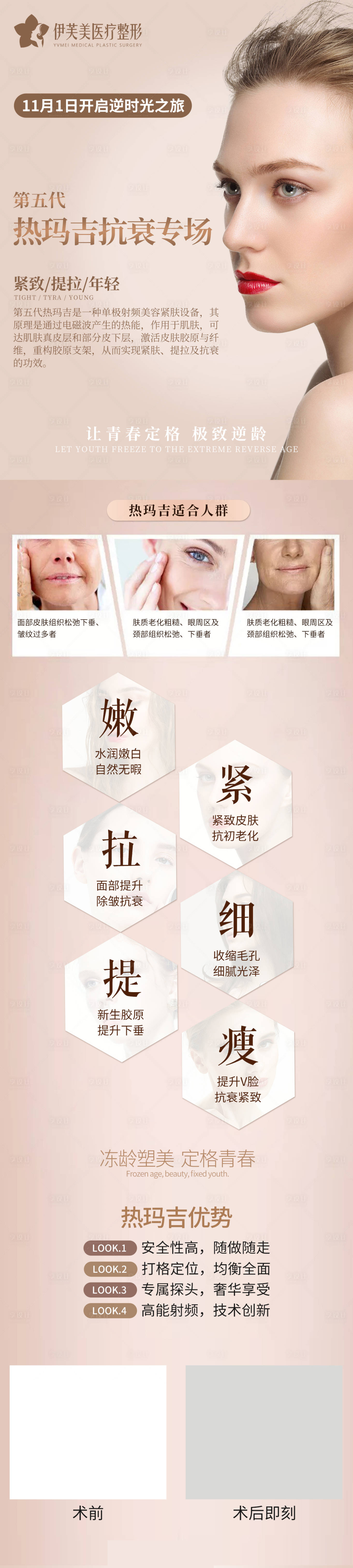 源文件下载【享设计】搜索编号：47850006709026286【第五代热玛吉医美整形海报长图】