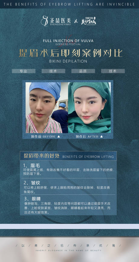 源文件下载【享设计】搜索编号：79810007053712331【医美整形案例】