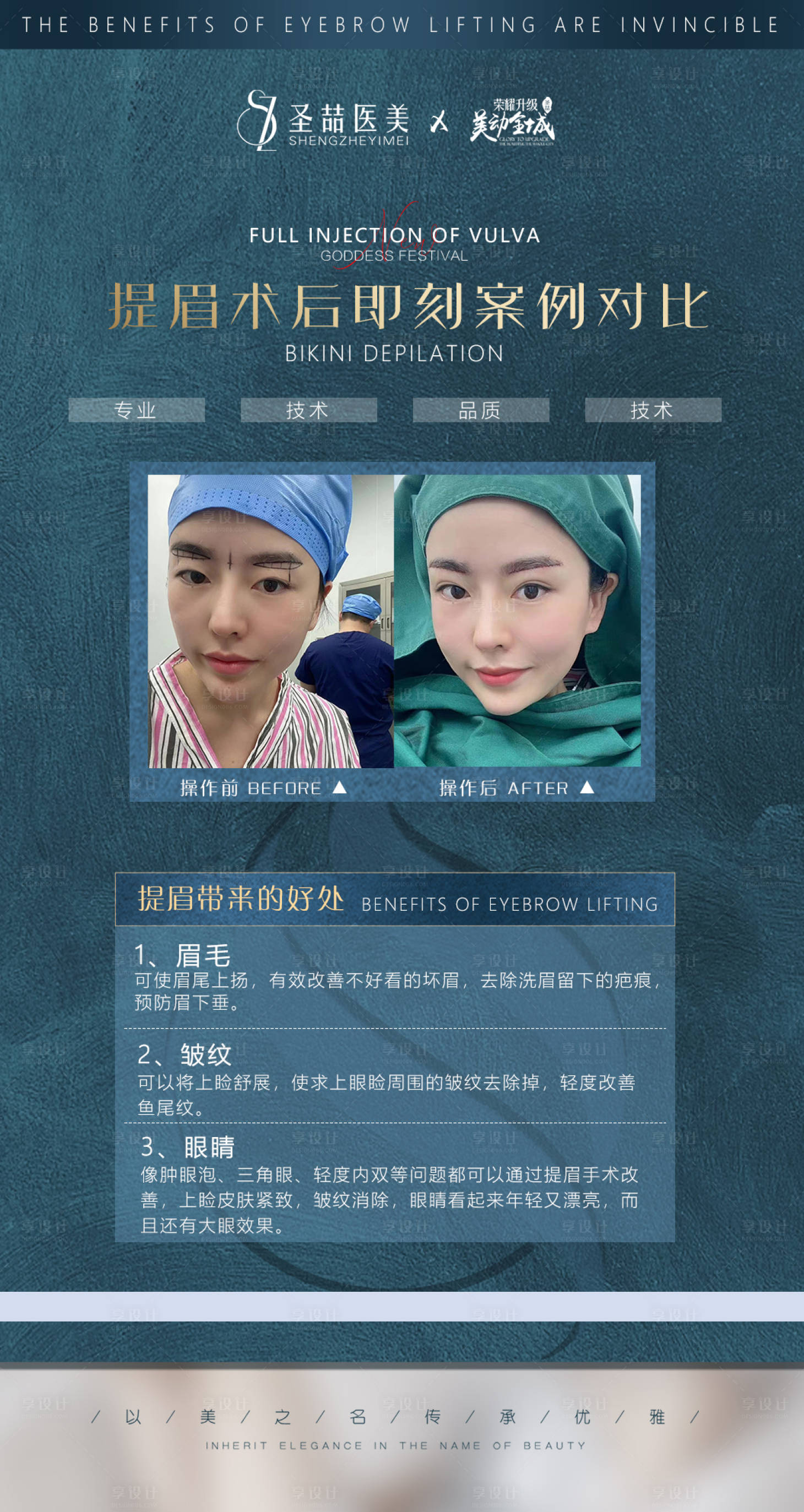 源文件下载【医美整形案例】编号：79810007053712331