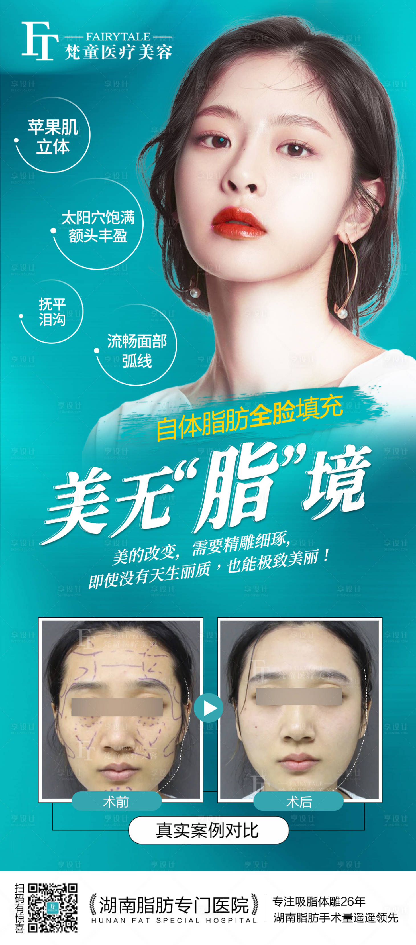 源文件下載【享設計】搜索編號：30230006890956832【脂肪填充海報】