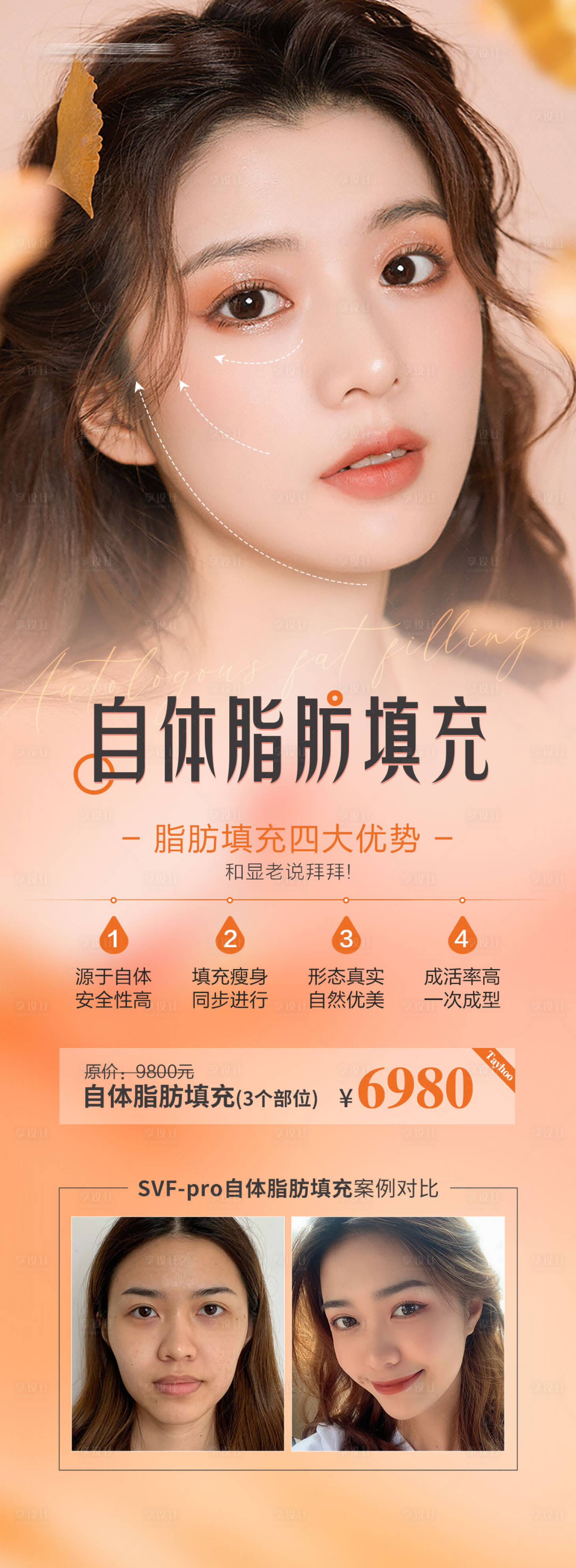 源文件下载【脂肪填充海报】编号：14100006867307689
