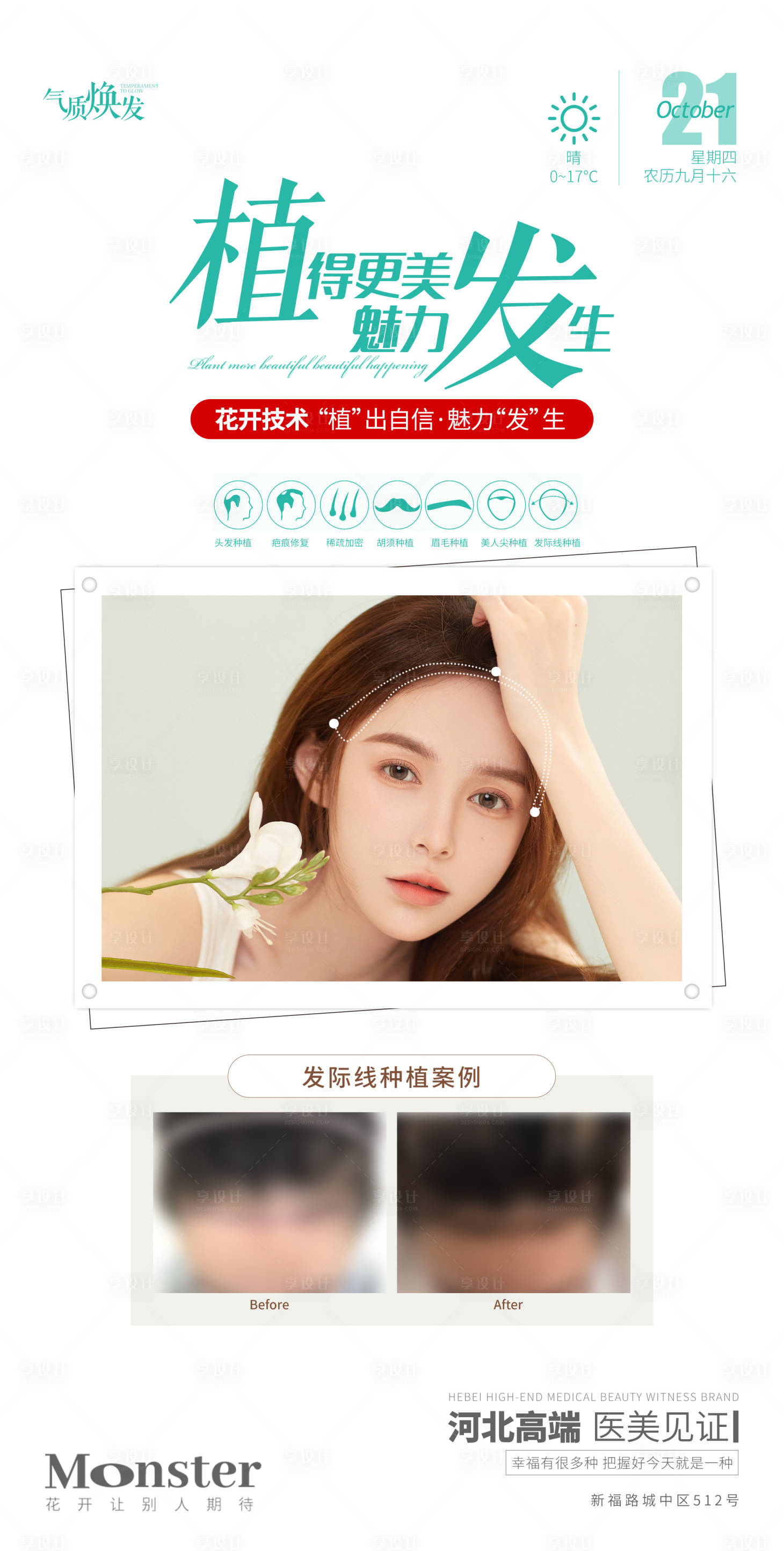 源文件下载【医美植发海报】编号：72860006962415926