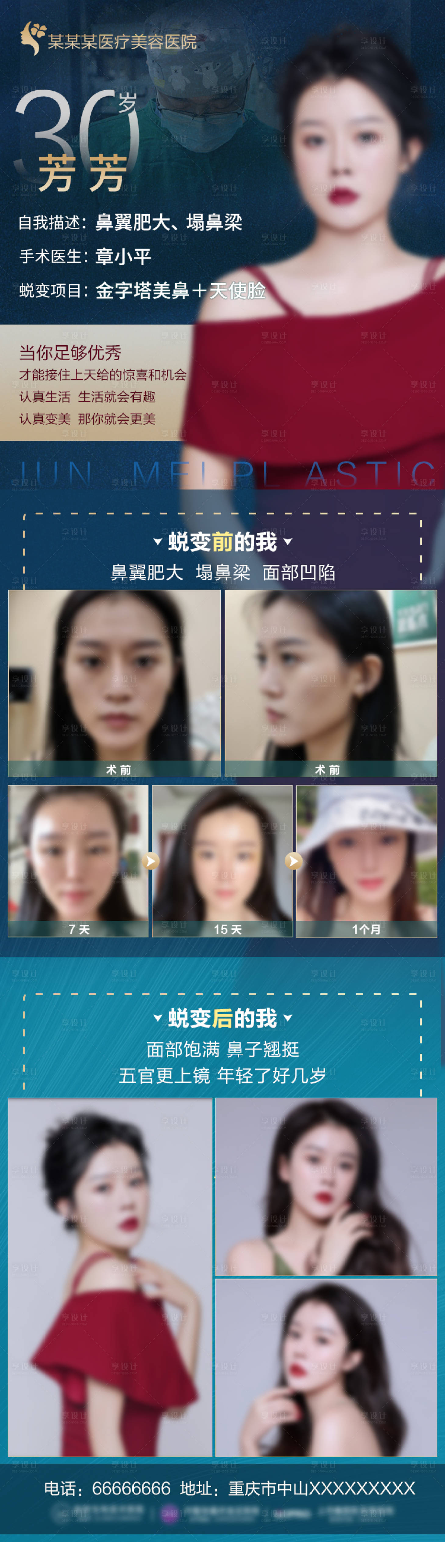 源文件下載【醫美蛻變案例長圖海報】編號：13270006774991046