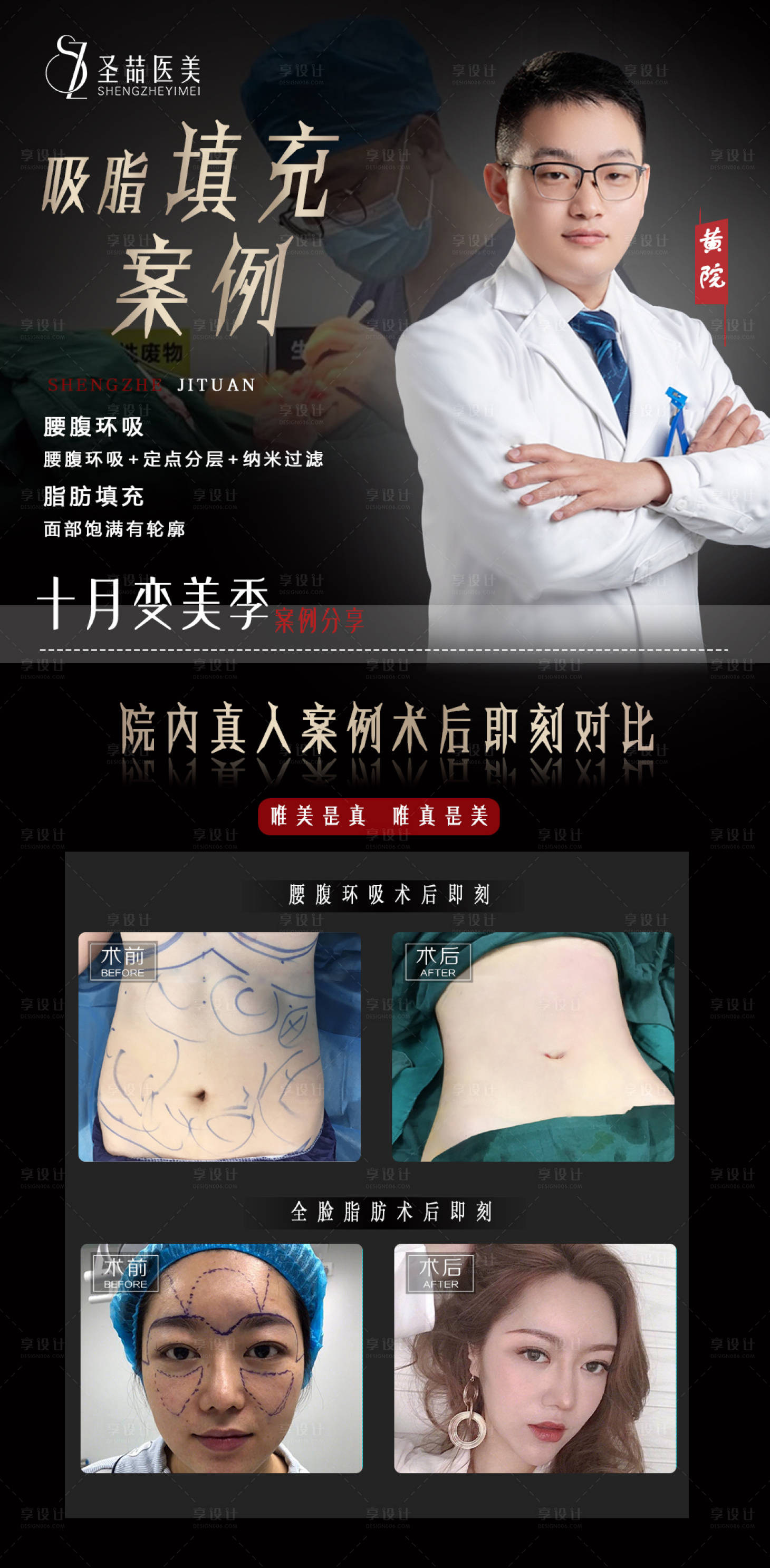 源文件下載【醫美整形案例】編號：37150006809694845