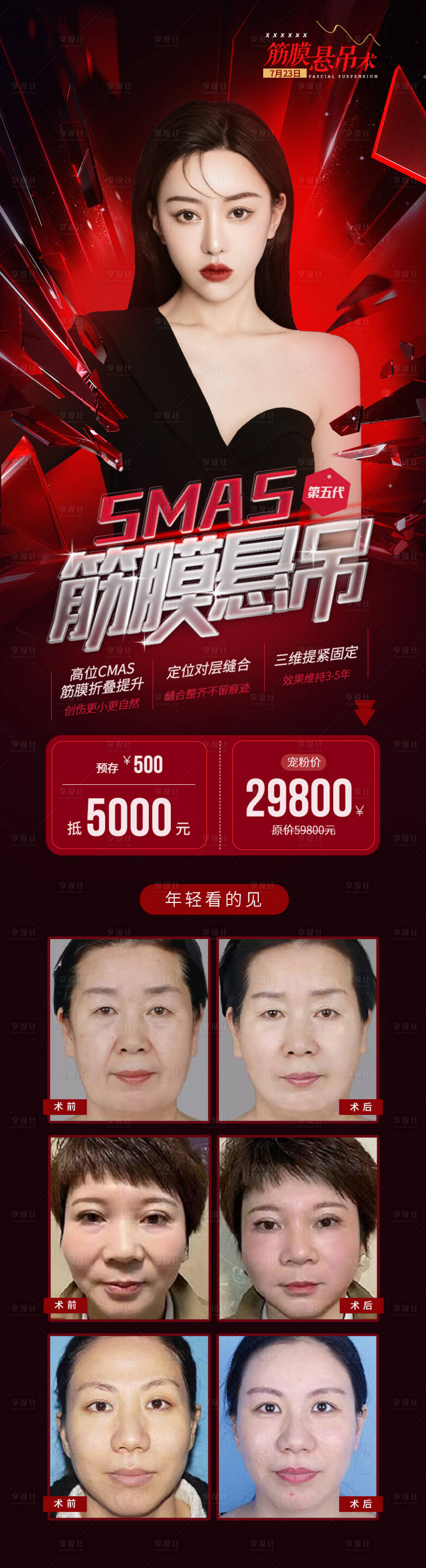源文件下载【医美筋膜悬吊术海报】编号：50550007002158028