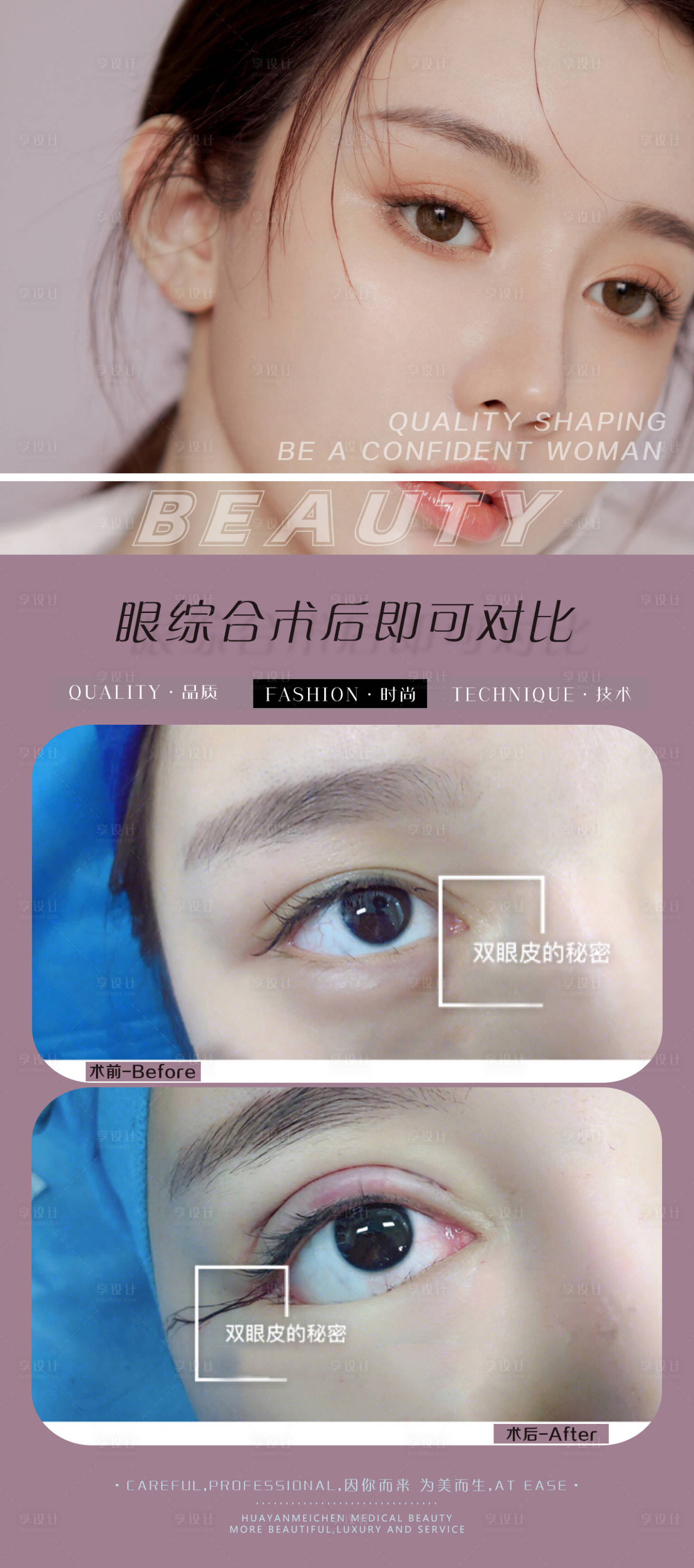 源文件下载【眼综合对比】编号：76240007004326347