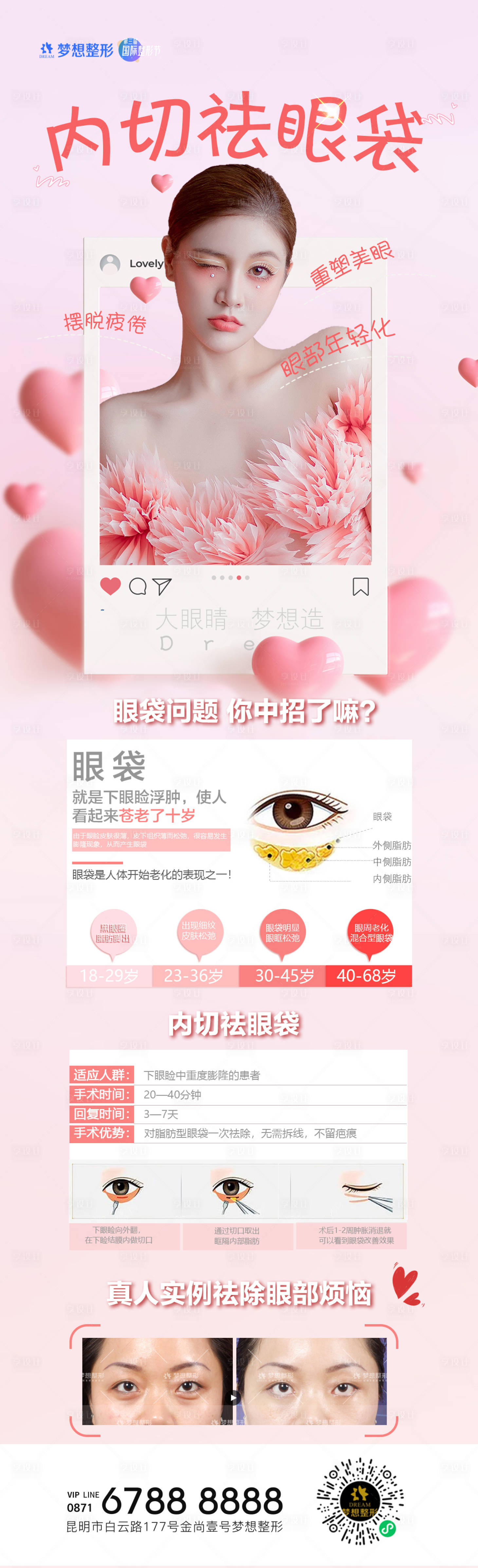 源文件下载【医美内切祛眼袋详情】编号：50970006841638960