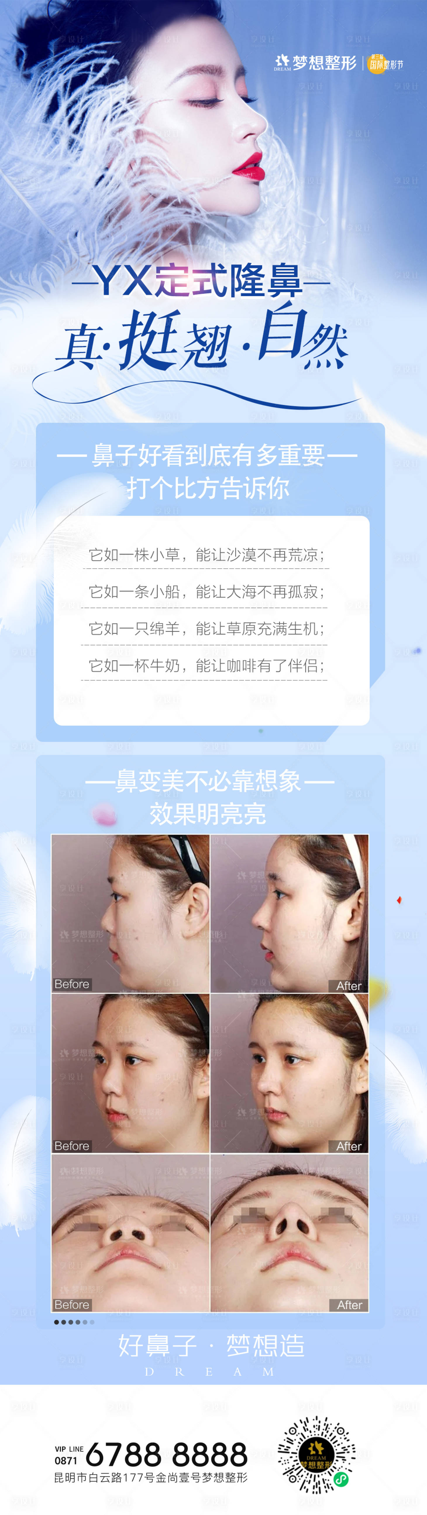 源文件下載【享設計】搜索編號：64400006840926198【醫美隆鼻案例對比 】