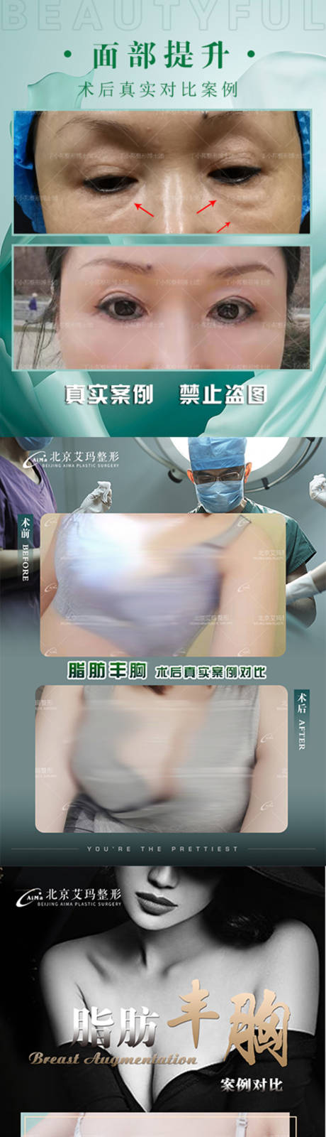 源文件下载【医美案例对比海报】编号：32490007016512809