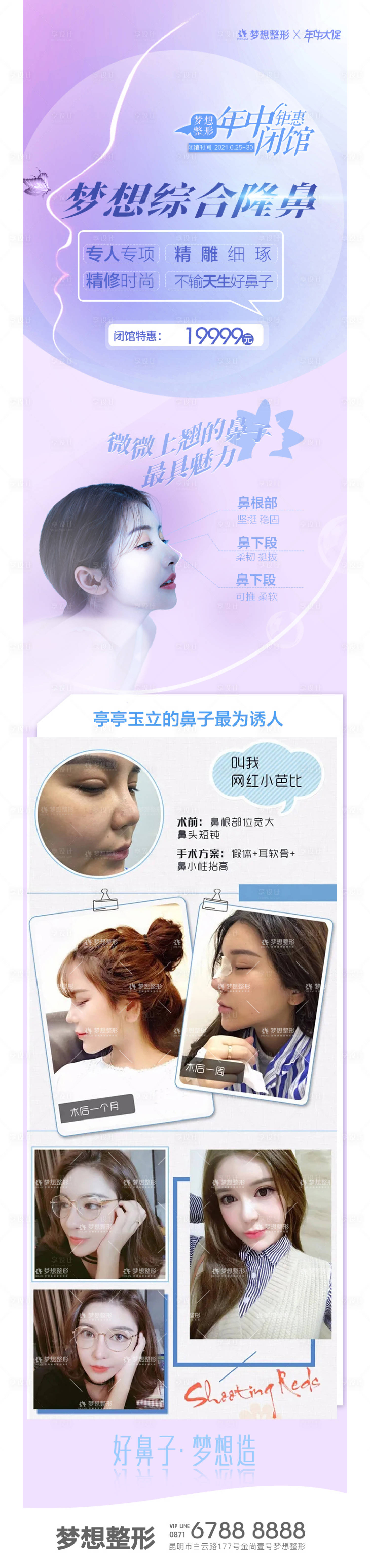 源文件下載【享設計】搜索編號：93380006840315457【夢想綜合隆鼻6】