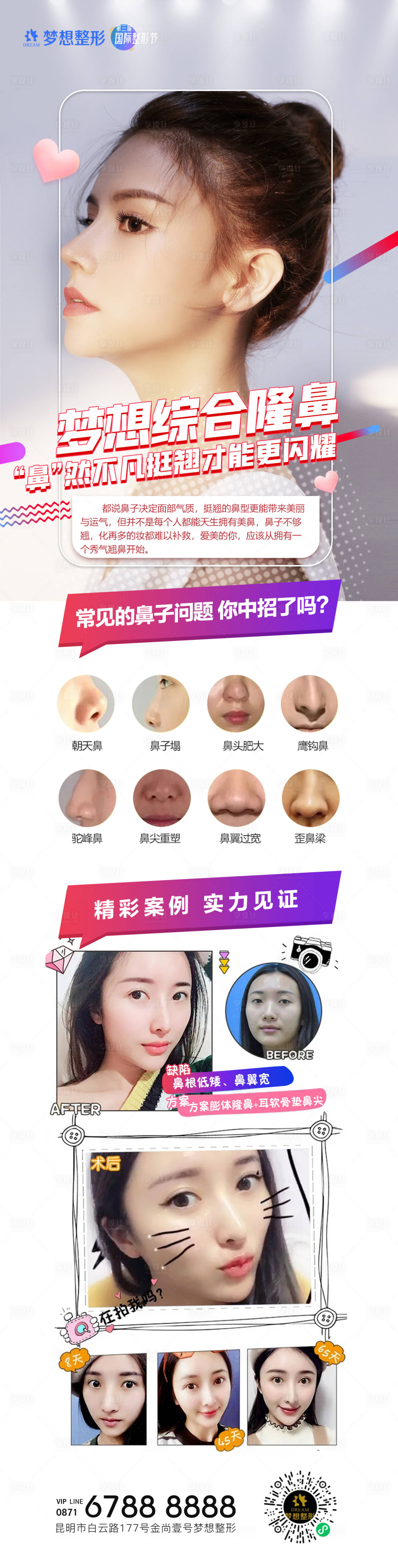 源文件下载【医美隆鼻详情长图海报】编号：30060006840969647
