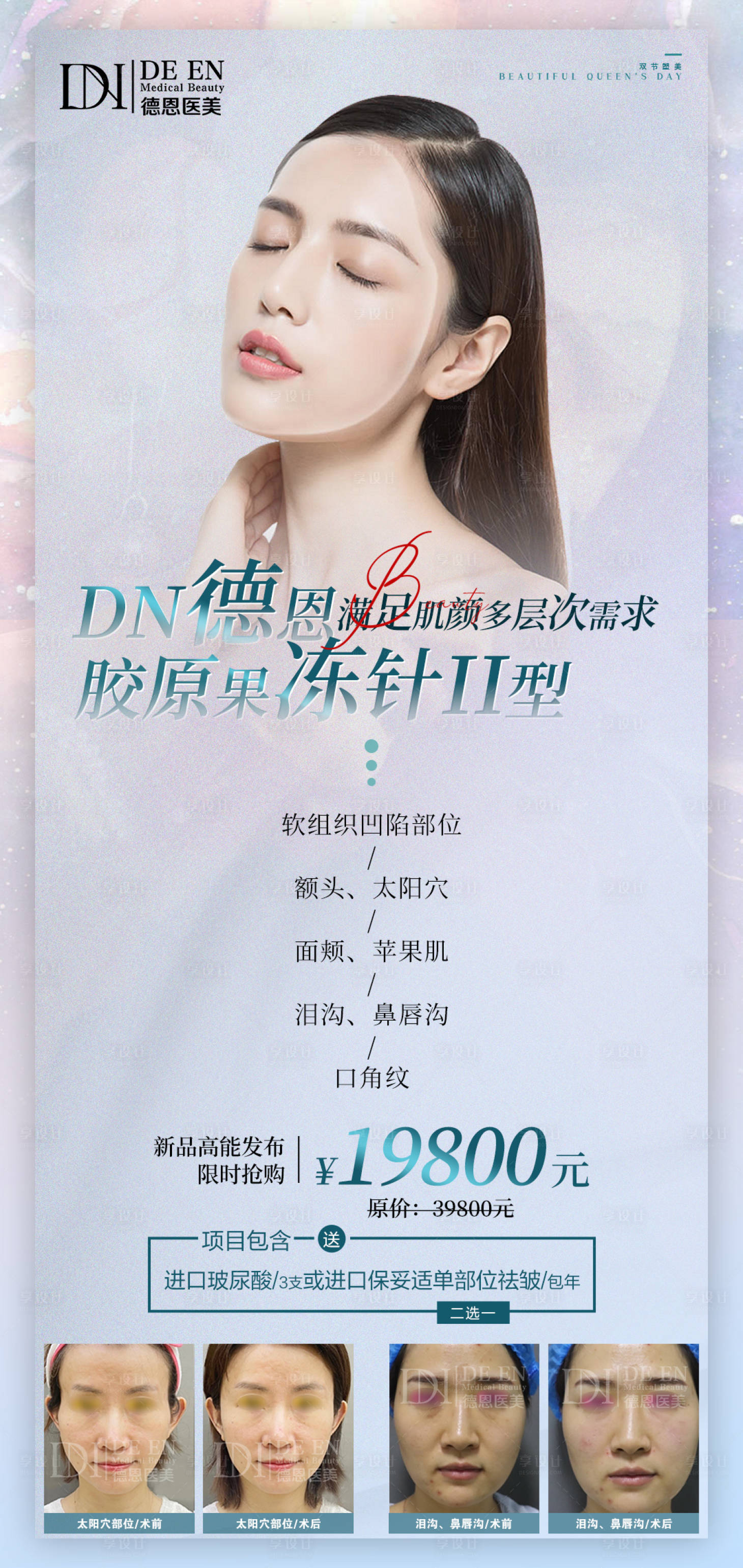 源文件下載【享設(shè)計】搜索編號：95350006765721974【醫(yī)美新品項目海報】