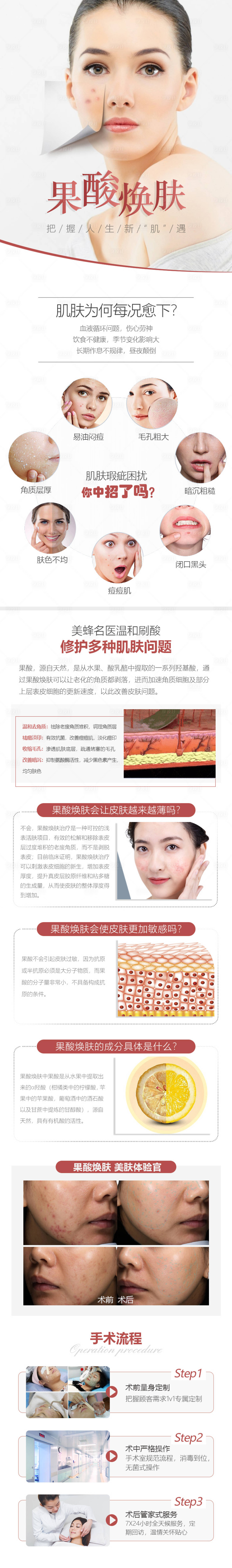 源文件下载【果酸焕肤】编号：17740007016037166