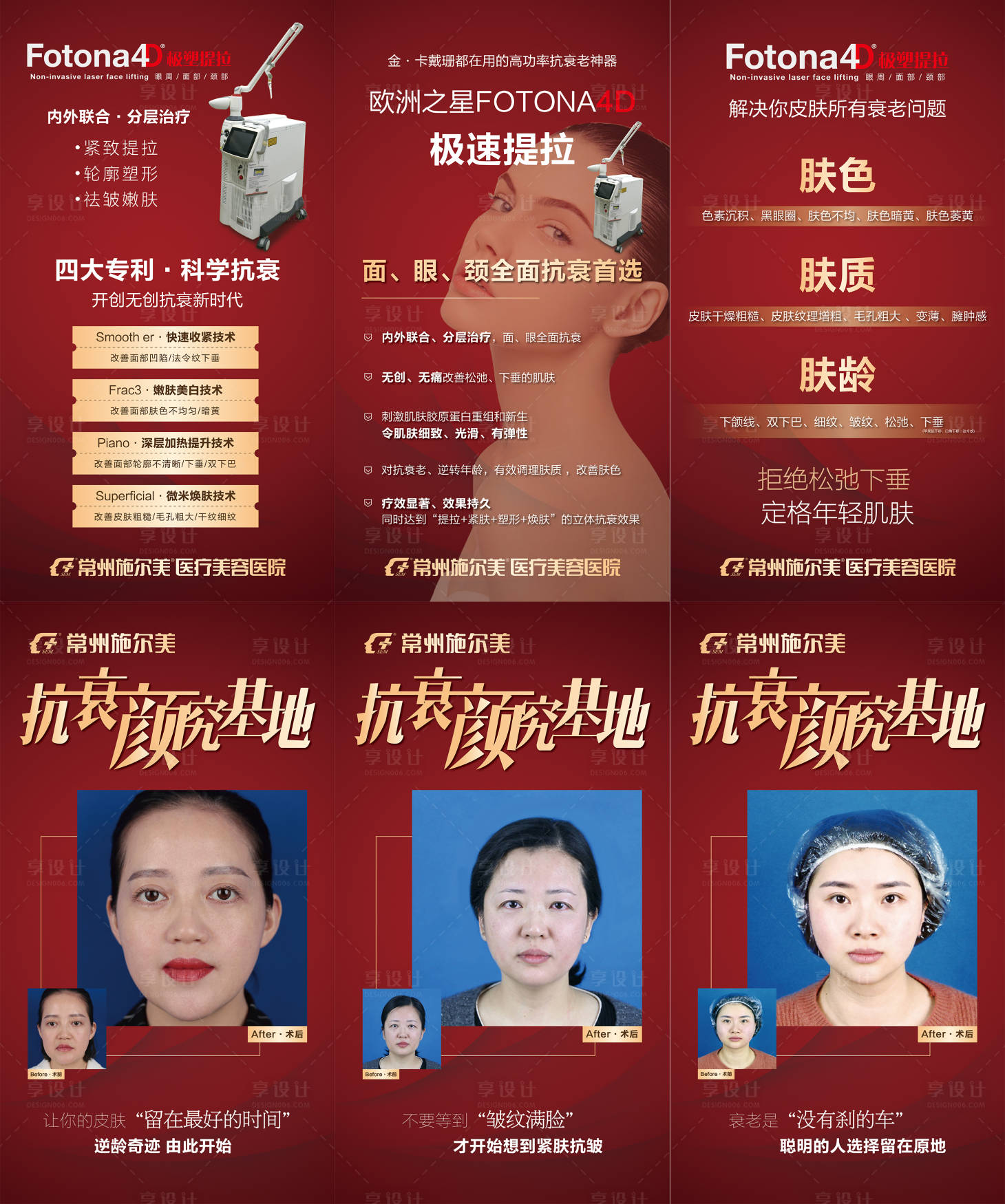 源文件下載【享設計】搜索編號：45070006851389492【醫美fotona長圖海報】