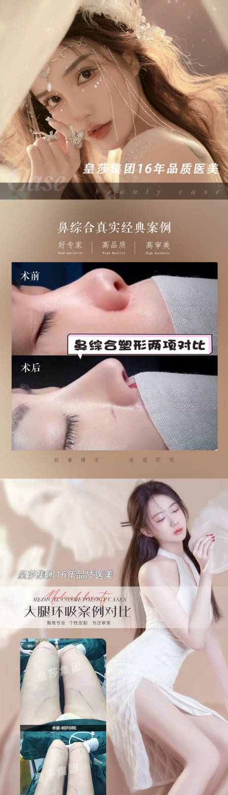 源文件下载【医美案例宣传海报长图】编号：80210007244245326