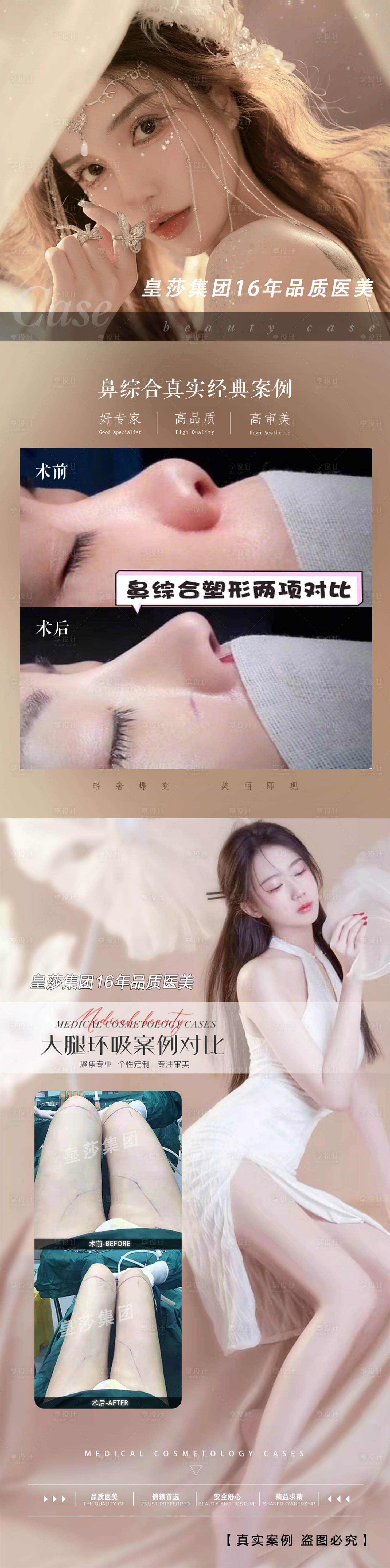 源文件下载【医美案例宣传海报长图】编号：80210007244245326