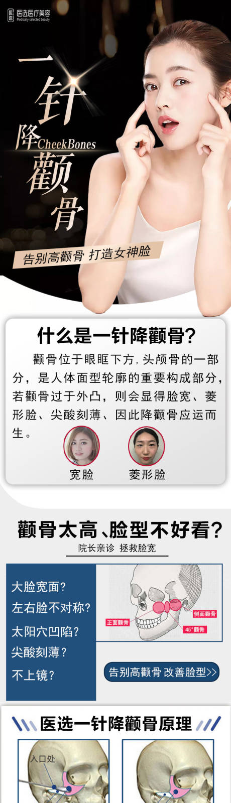 源文件下载【医美整形一针降颧骨v脸电商详情】编号：14720007174145912