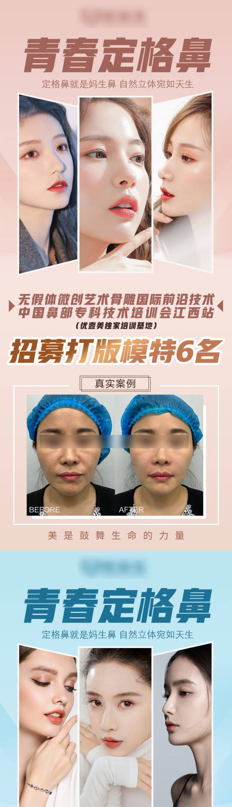源文件下載【醫美招募模特案例海報】編號：87300007310211688