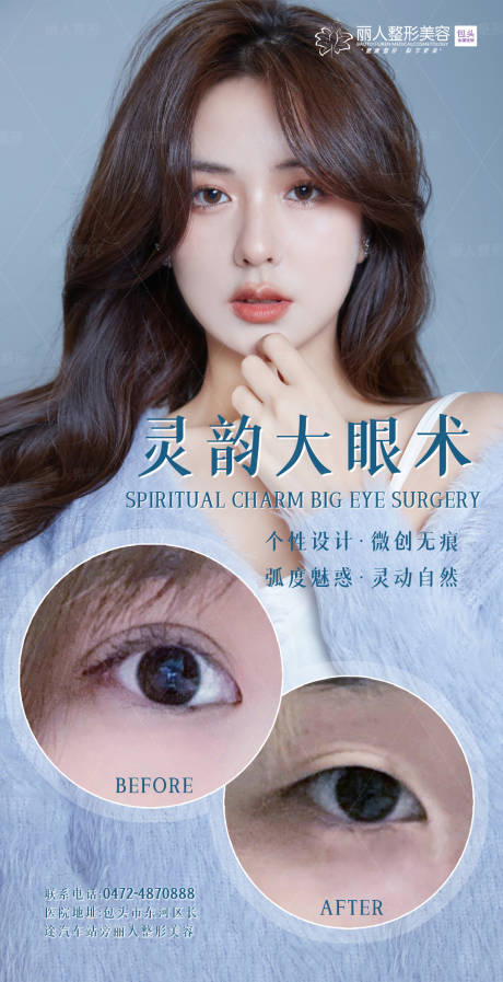 源文件下载【医美双眼皮案例】编号：30150007228265208