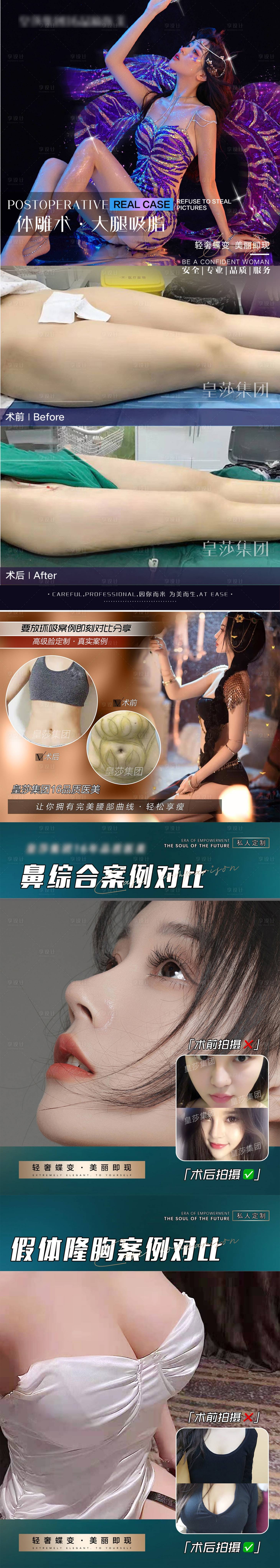 源文件下载【享设计】搜索编号：77030007301663000【医美案例大腿环吸海报】