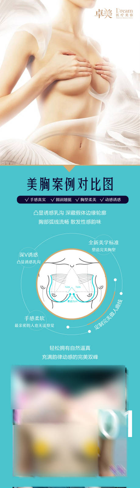 源文件下载【医美整形胸部案例对比图】编号：71480004808496001