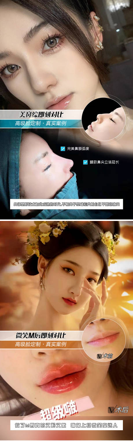 源文件下載【享設(shè)計(jì)】搜索編號(hào)：33310007368777088【醫(yī)美對(duì)比案例(TIF用PS打開(kāi))】