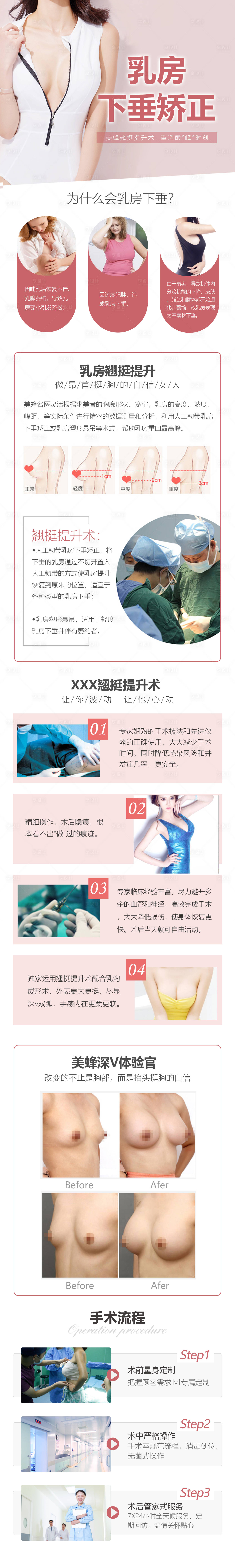 源文件下載【享設計】搜索編號：53250007394623277【乳房下垂矯正詳情頁】