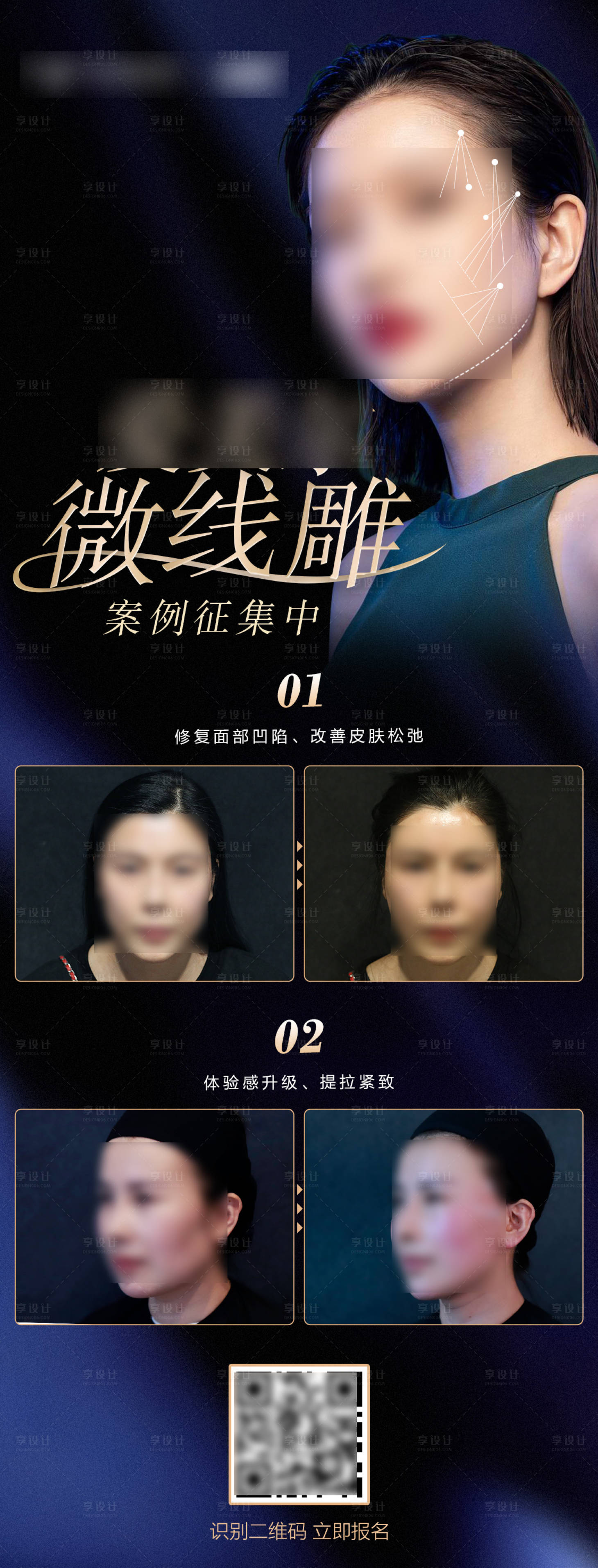 源文件下載【享設計】搜索編號：13290007365541317【0水腫微線雕案例征集長圖海報】