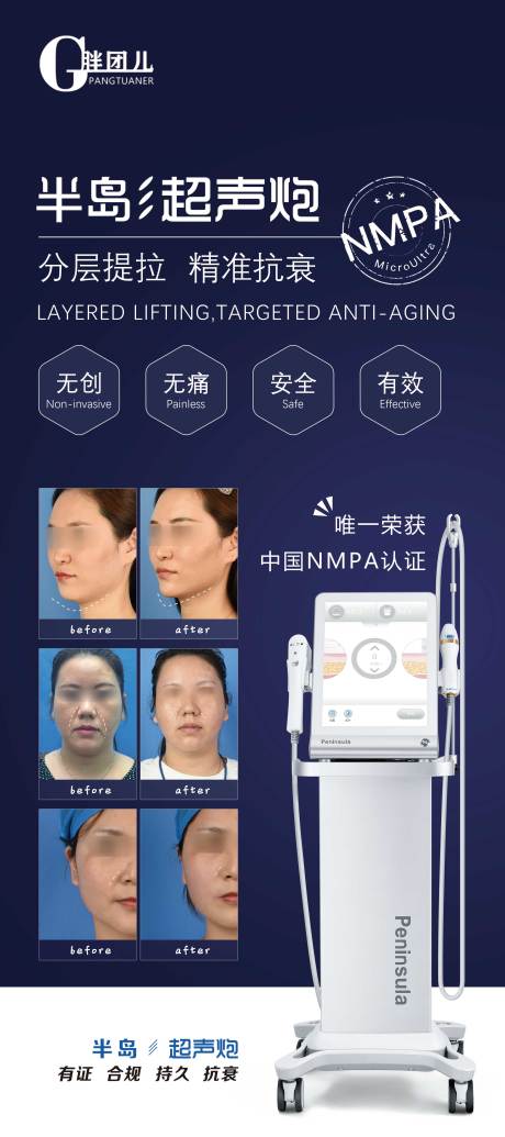 源文件下载【医美超声炮展架易拉宝】编号：43100007311378470