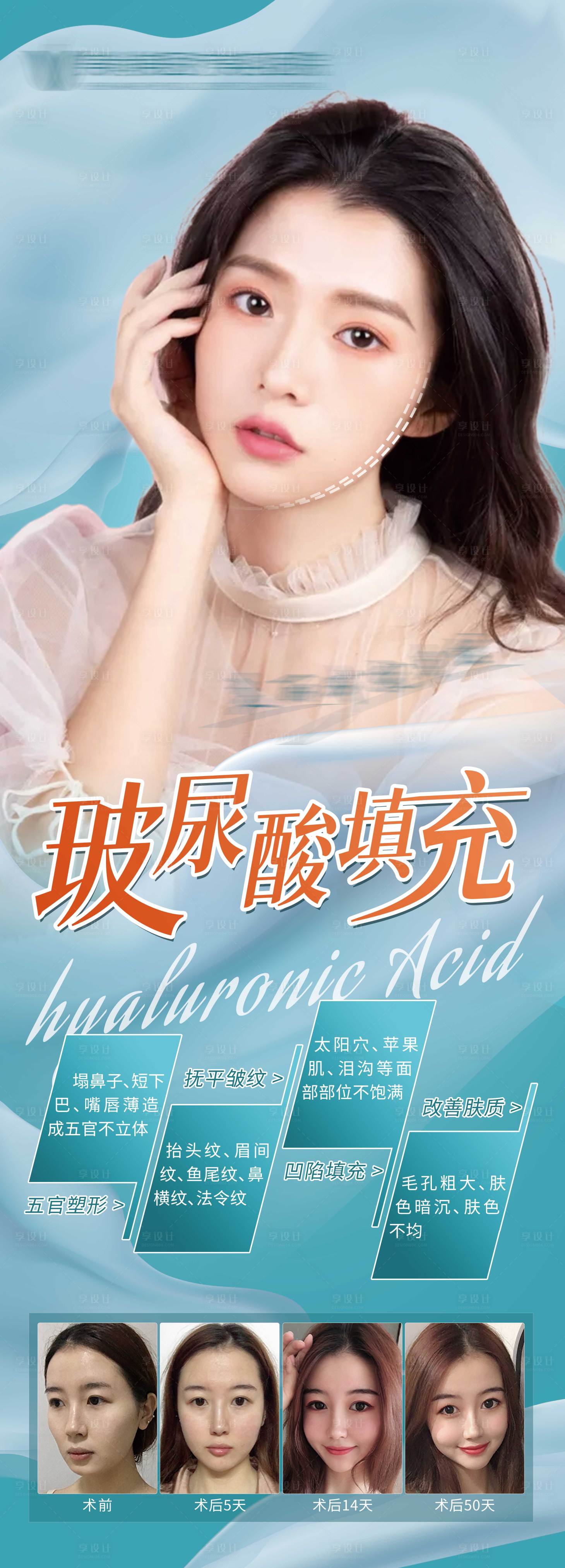 源文件下载【享设计】搜索编号：24250007347445131【医美玻尿酸填充】