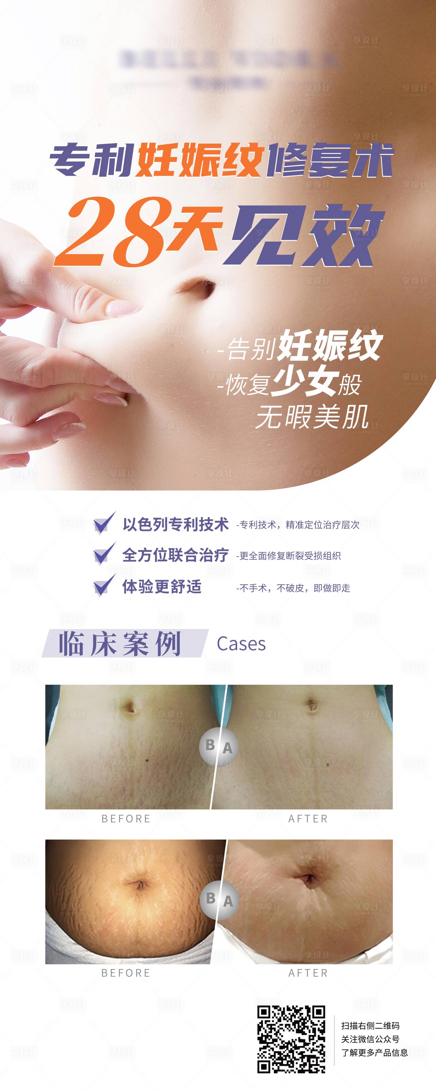 源文件下载【妊娠纹修复易拉宝】编号：90800007253474693