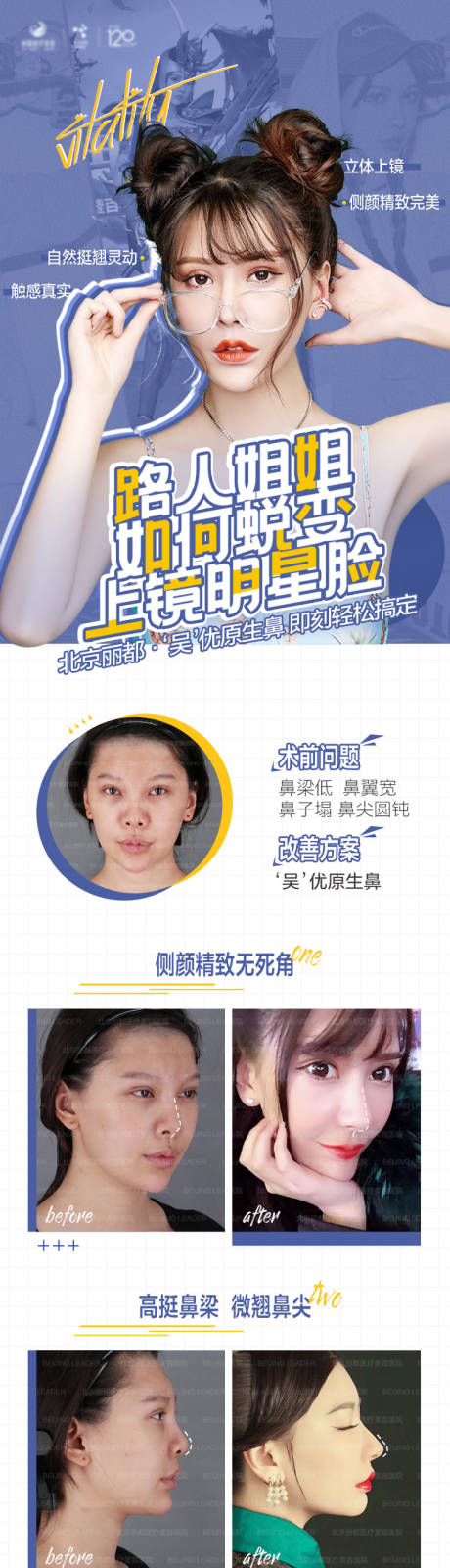 源文件下载【鼻部 】编号：93830007158873083