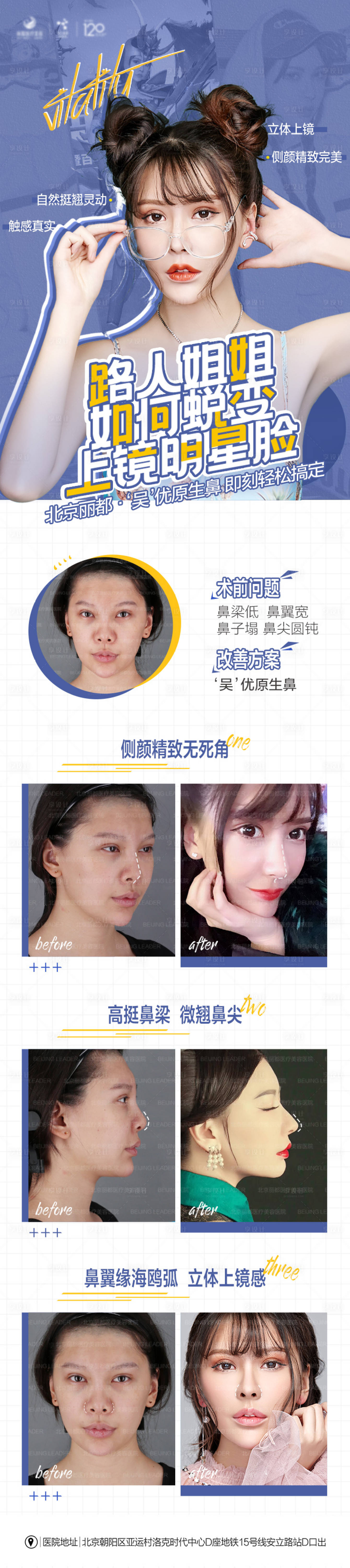 源文件下载【享设计】搜索编号：93830007158873083【鼻部 】