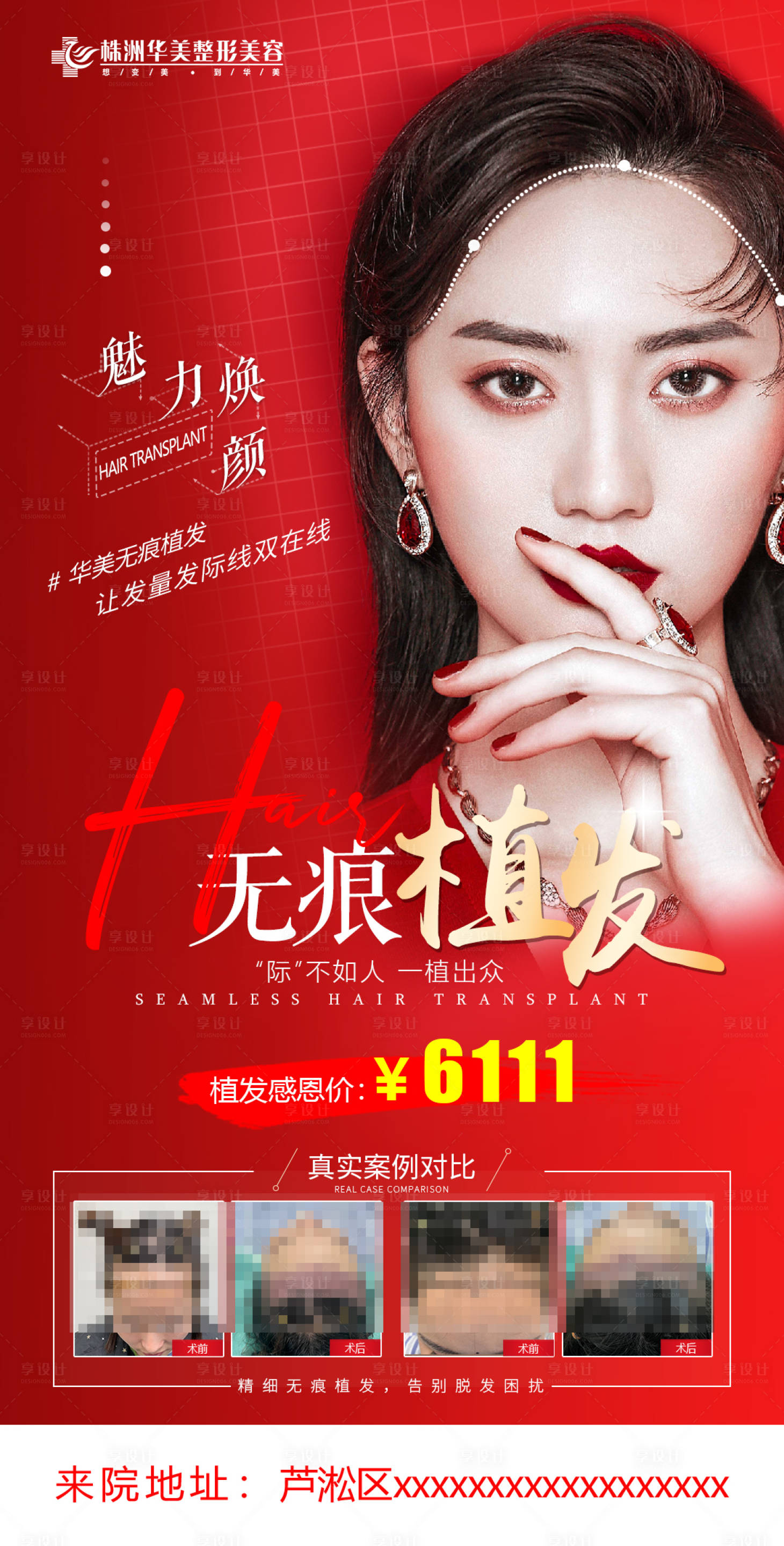 源文件下載【享設計】搜索編號：98850007284033080【醫美植發海報】