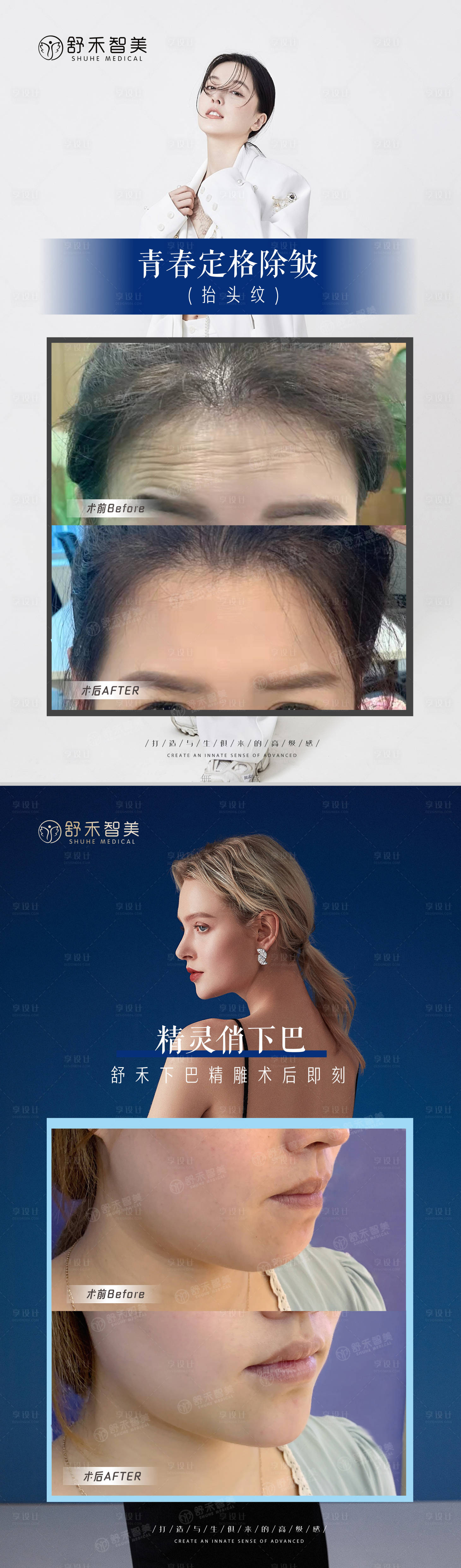 源文件下載【享設計】搜索編號：89180007190603169【醫美活動案例海報】