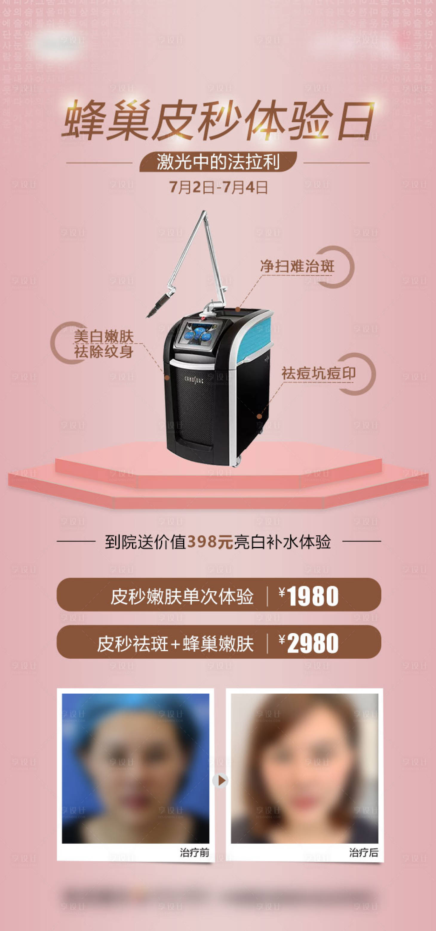 源文件下载【享设计】搜索编号：10110007101444949【医美蜂巢皮秒祛斑体验日案例对比海报】