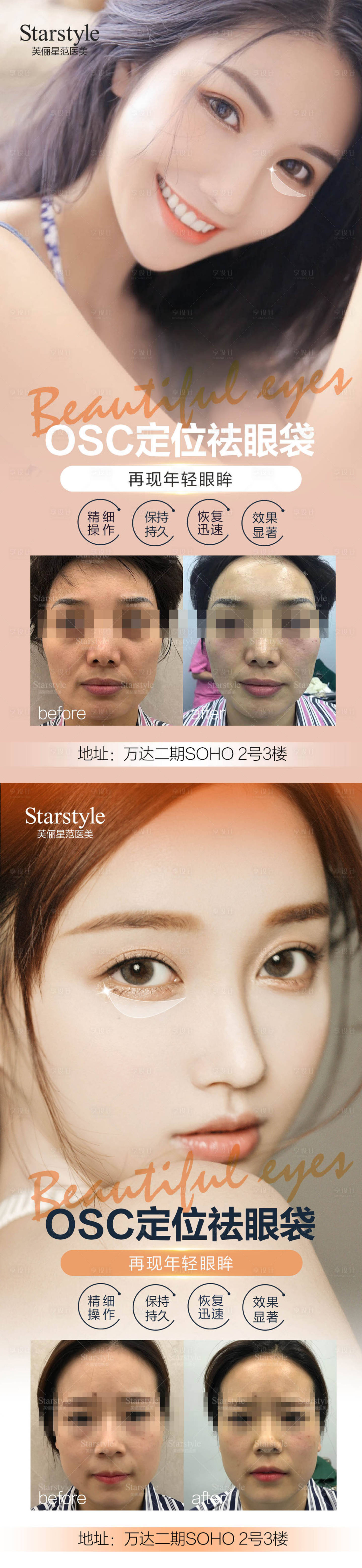 源文件下载【享设计】搜索编号：49610007434508350【医美祛眼袋人物系列海报】