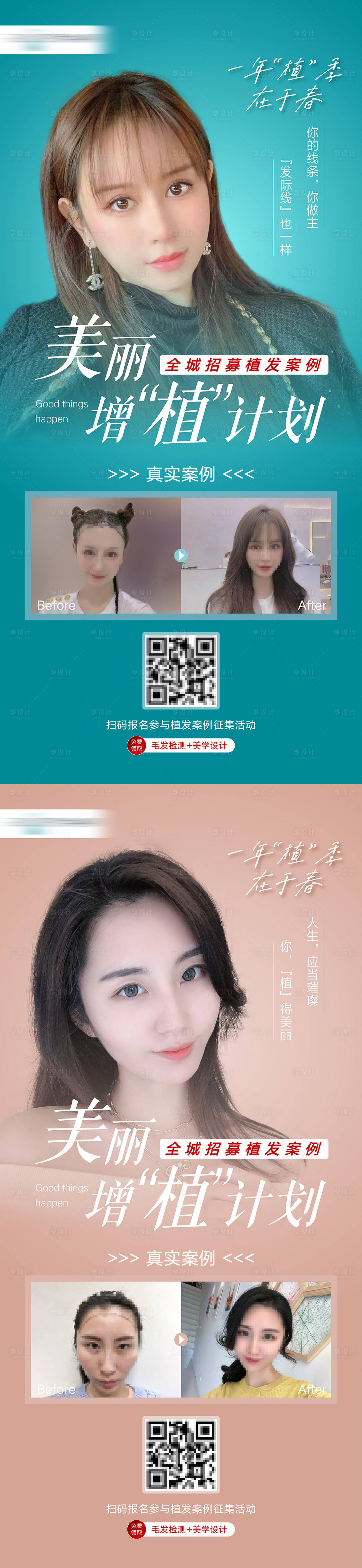 源文件下載【享設計】搜索編號：17050007329457539【植發案例招募】