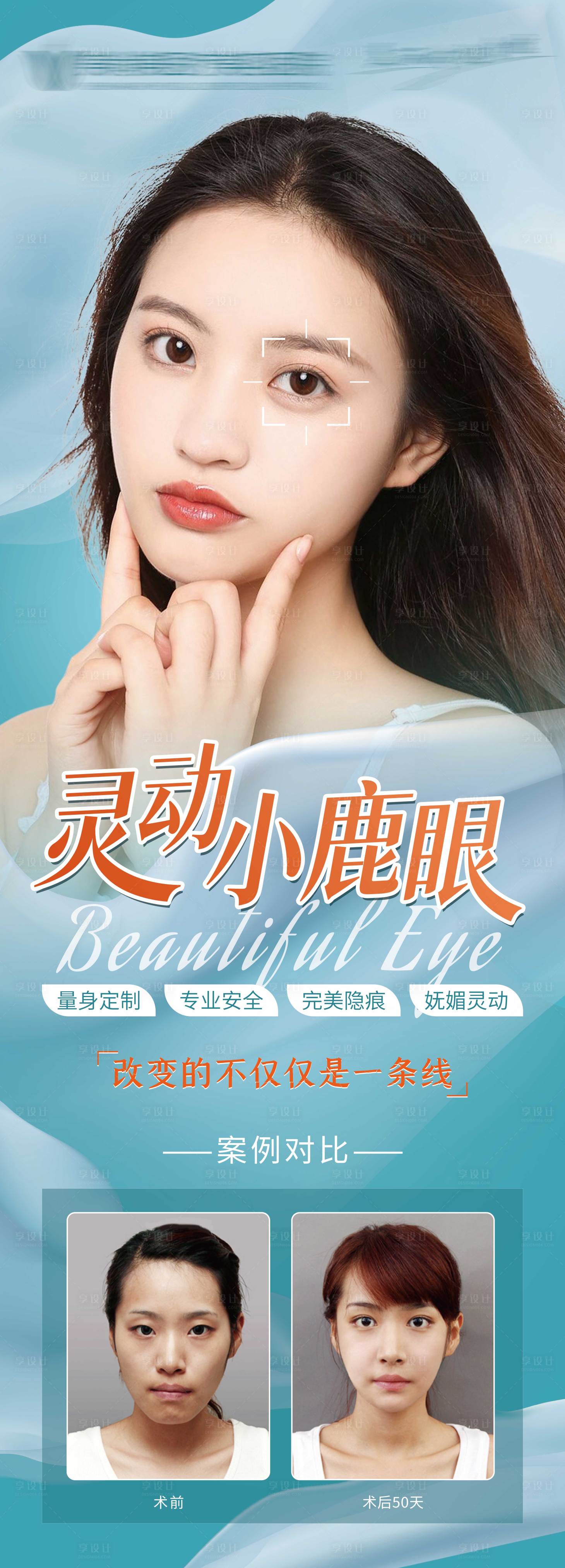 源文件下载【医美眼整形】编号：91760007347521207