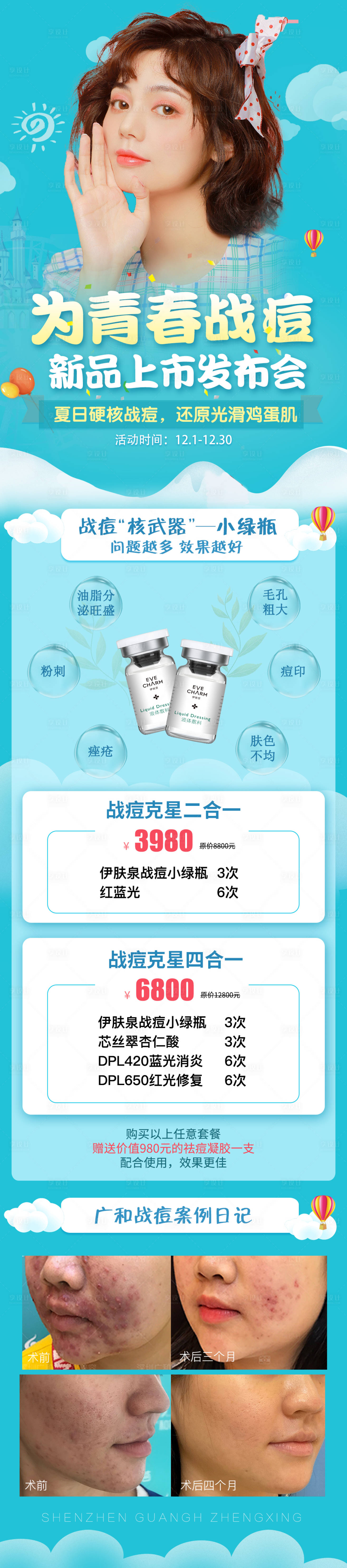 源文件下载【医美祛痘新品上市长图海报】编号：44410007165275248
