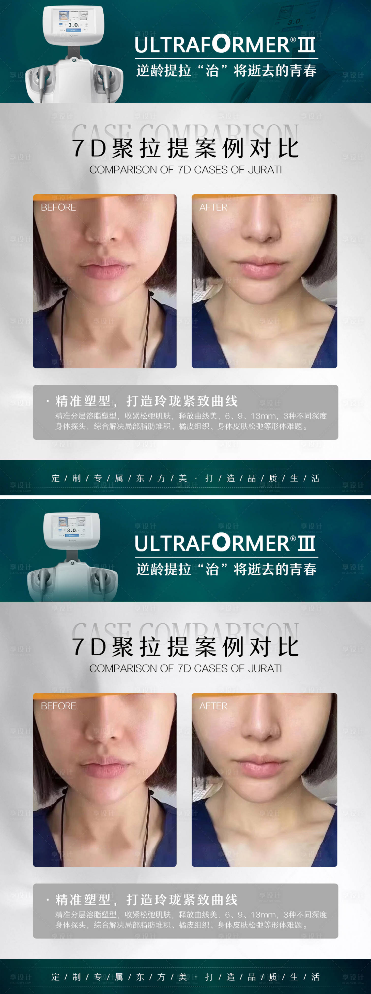 源文件下載【享設計】搜索編號：13810007257083407【醫美7D聚拉提案例對比海報】